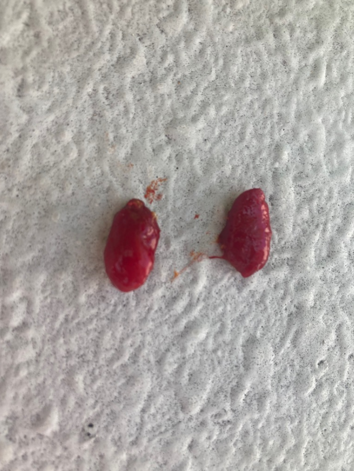 seed